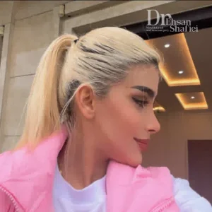 عمل بینی