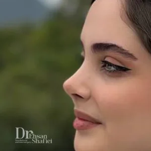 مشکلات بعد از عمل بینی طبیعی