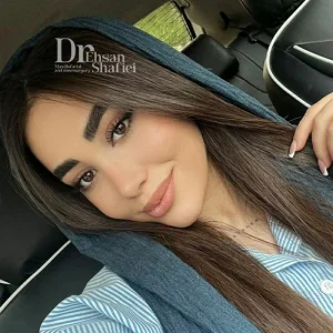 سوالات رایج درباره بینی استخوانی