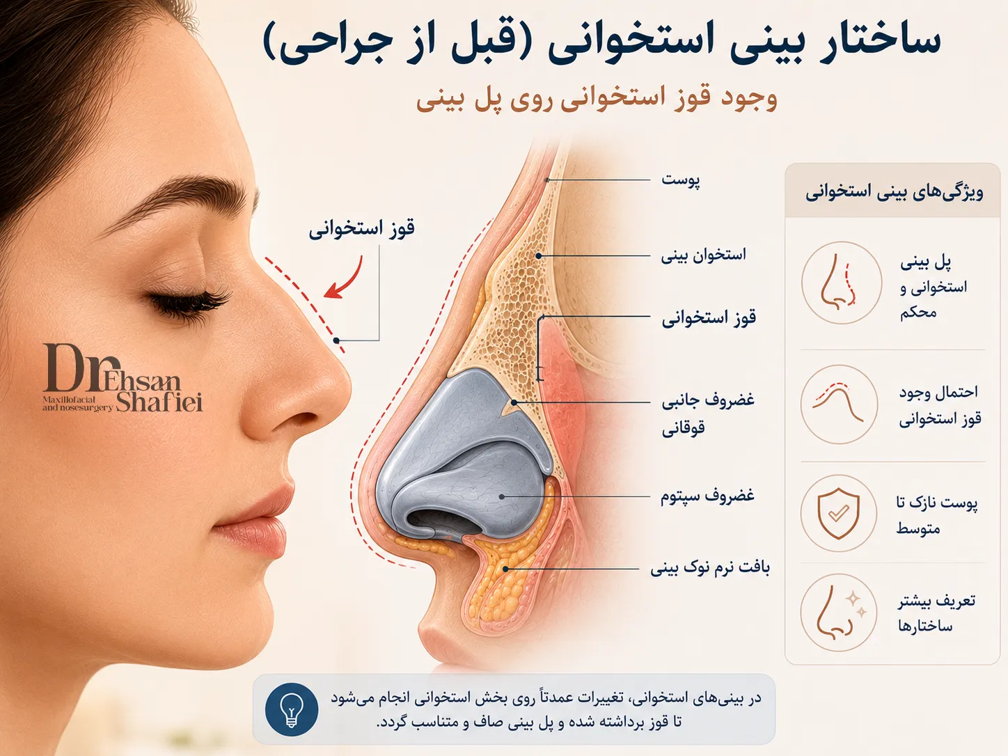 جراحی بینی استخوانی؛ همهچیزی که قبل از تصمیم باید بدانید