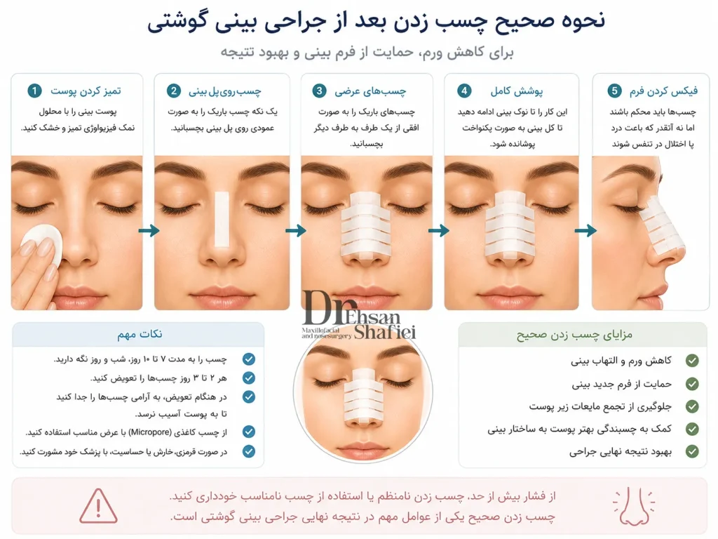 روش صحیح چسب زدن بینی بعد از عمل بینی گوشتی