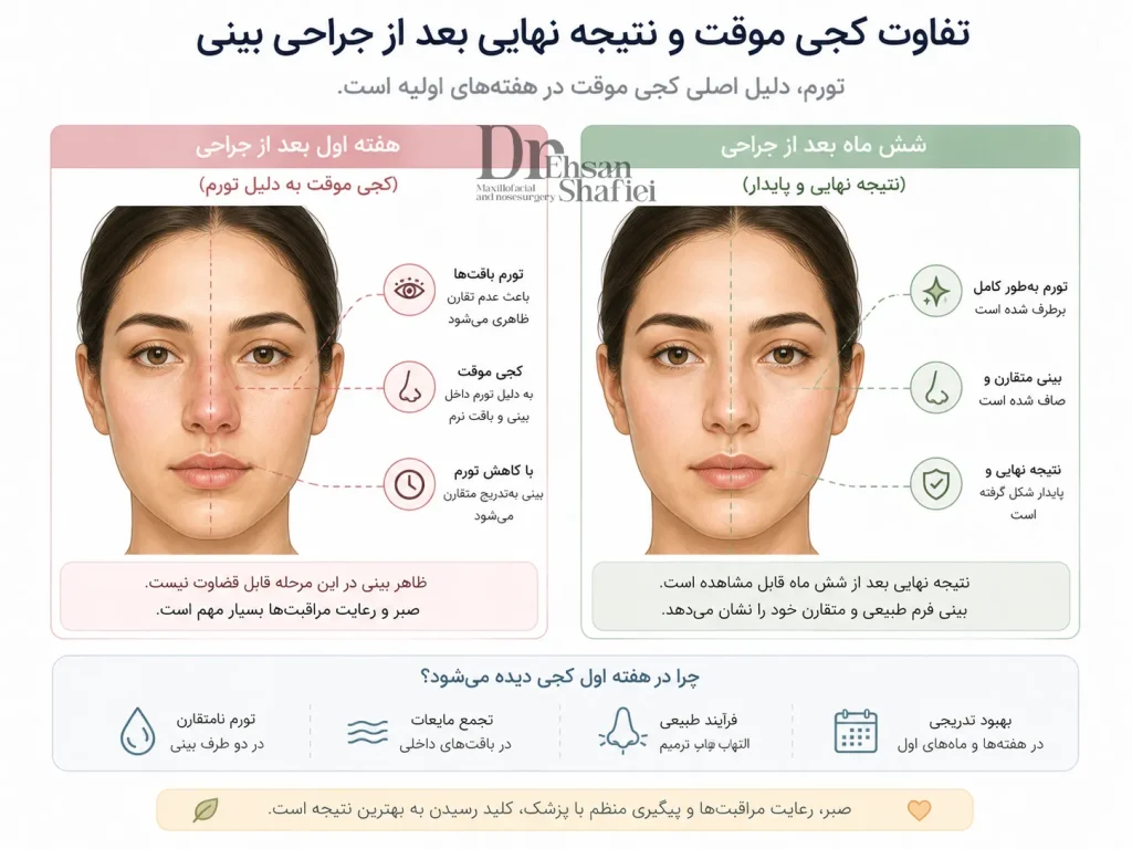 مقایسه کجی موقت ناشی از تورم و نتیجه نهایی متقارن