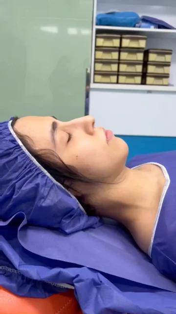 عمل بینی گوشتی دخترانه و نقش صبر در خوابیدن ورم