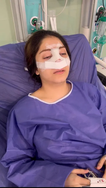 بیهوشی و ریکاوری عمل بینی واقعا چگونه است