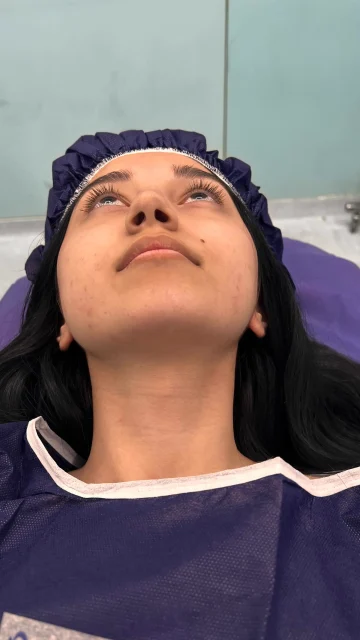 تناسب بینی با اجزای صورت؛ صورت یک کل است