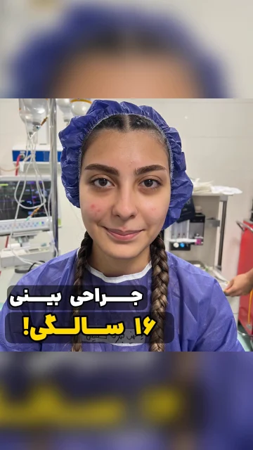 عمل بینی در افراد زیر ۱۸ سال