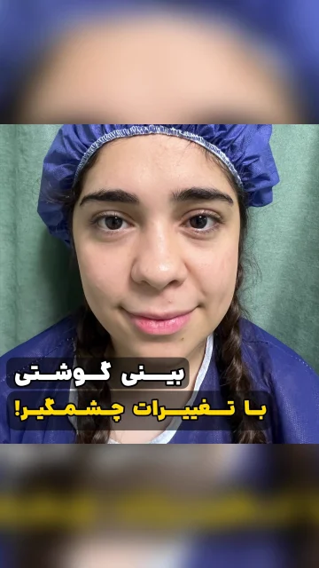 ورم بینی تا کی طول می‌کشد