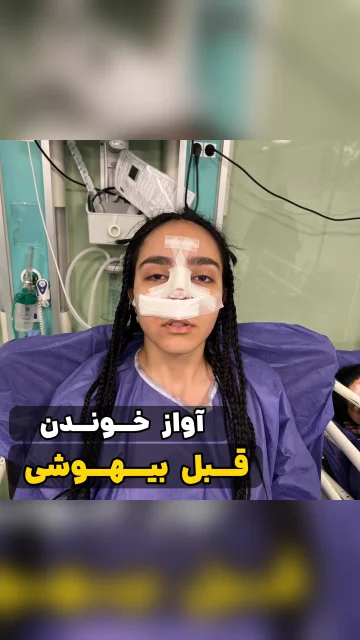 آیا عمل بینی صدا را تغییر می‌دهد