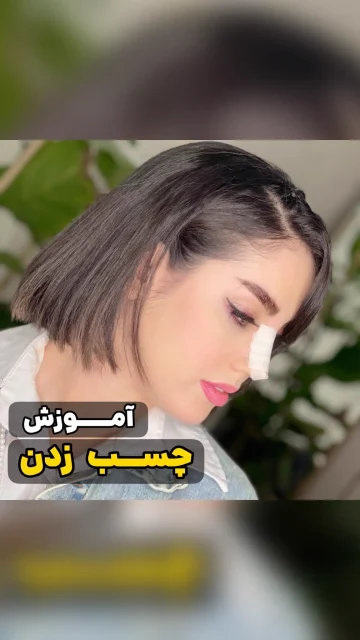 نحوه چسب زدن بینی بعد از عمل