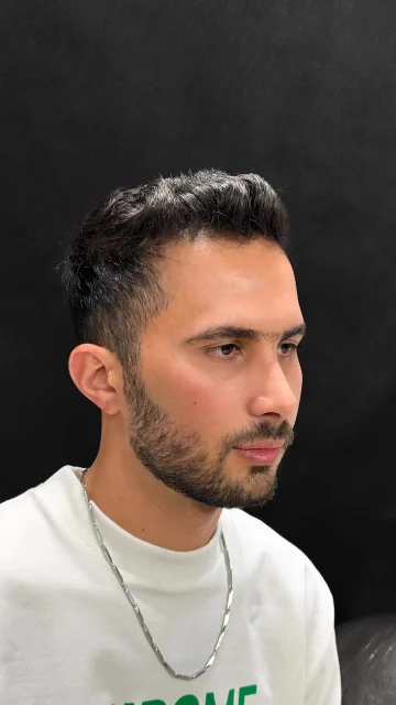 پرواز بعد از عمل بینی