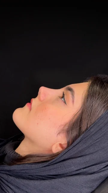 نمونه عمل بینی دکتر شفیعی