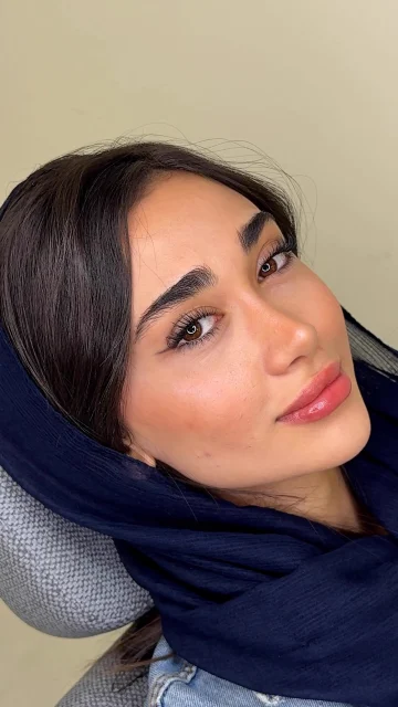 نمونه عمل بینی دکتر شفیعی