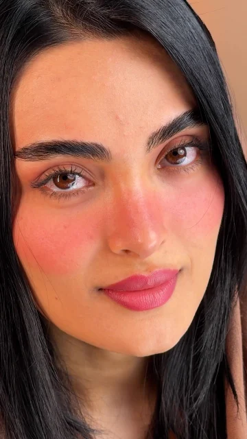 مراجعه از شهرهای دور برای عمل بینی