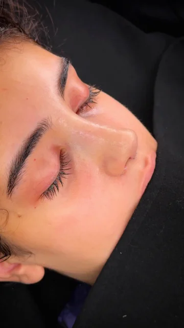 انرژی مثبت بیمار در اتاق عمل