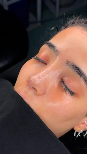 نمونه عمل بینی دکتر شفیعی